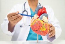 Heart Attack Risk